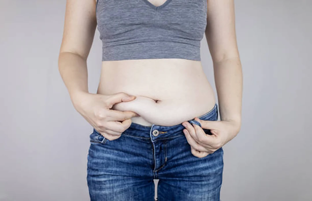 Abdominal Fat