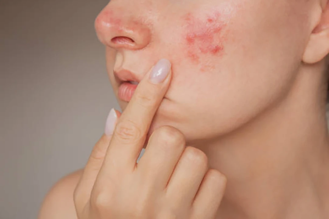 Help in reducing inflammation