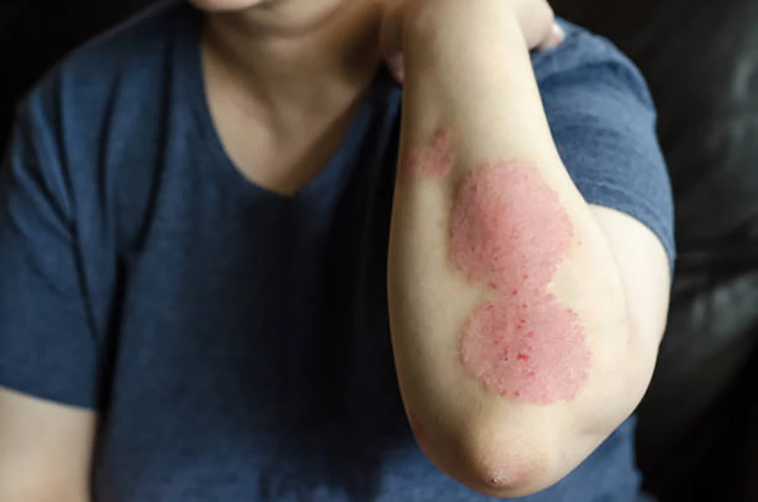 Help prevent infections