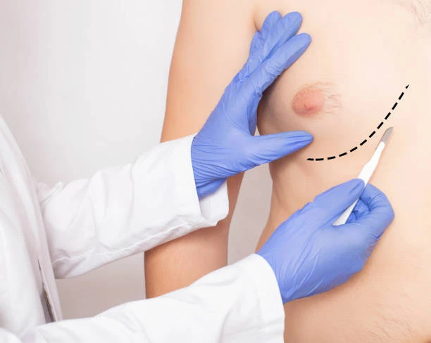 Non-Surgical Body Contouring Procedures