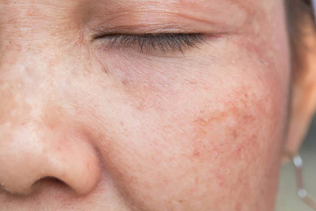 Protect against skin damage