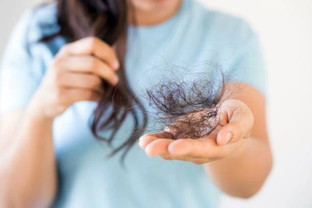 Reduces Hair Fall and Dandruff
