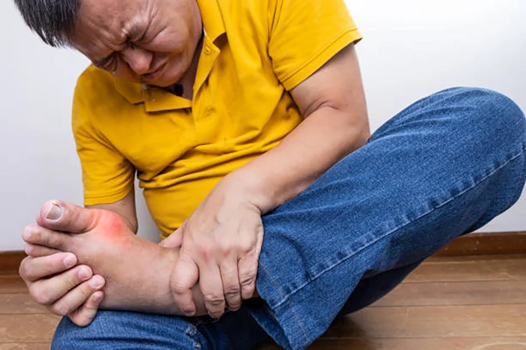 Reduces Pain in Gouty Arthritis