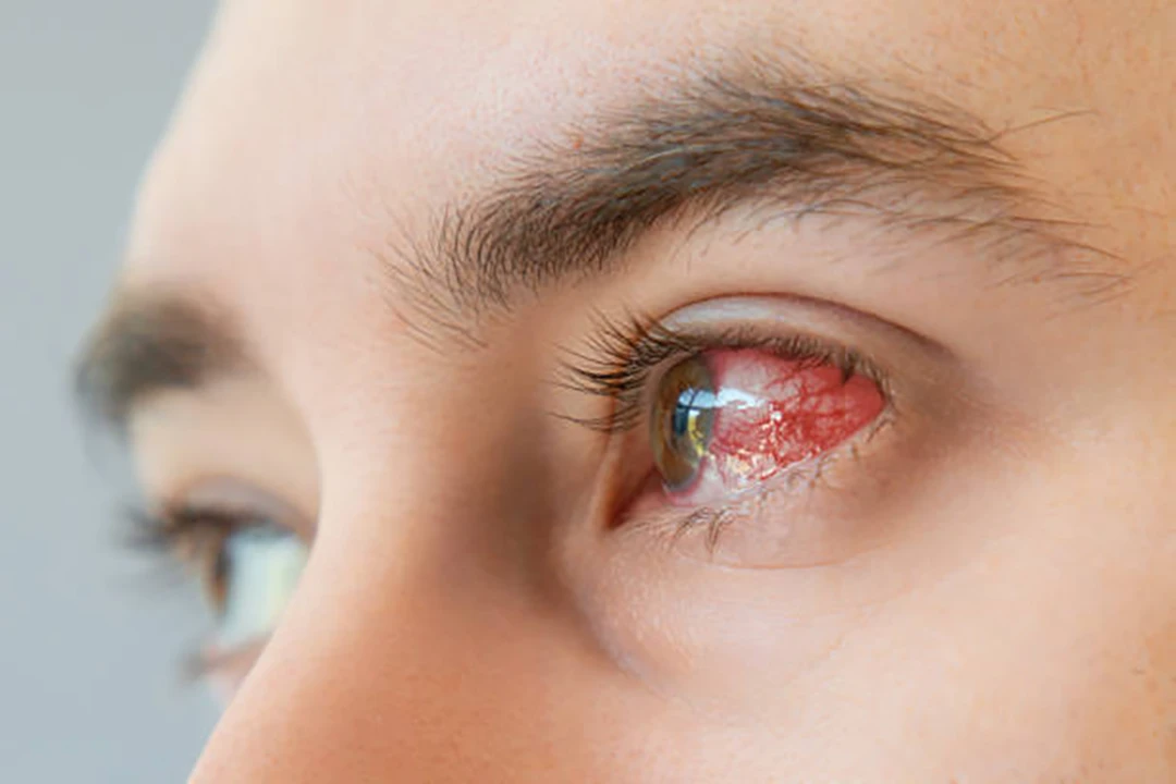 Treat various infections